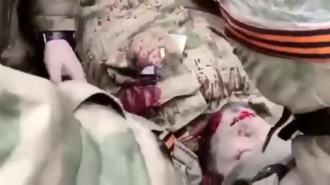 ⁣Оказание первой медицинской помощи раненному бойцу чеченского подразделения 30.03.2022