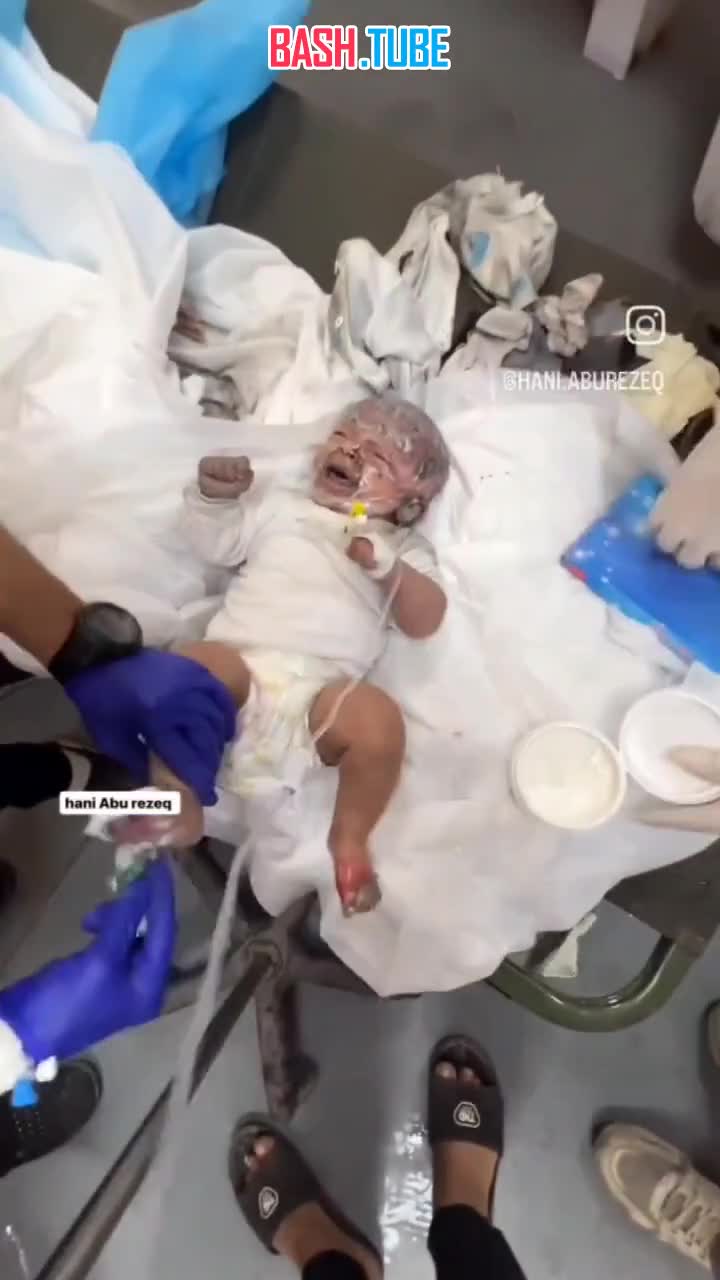  Спасенный в одной из больниц Газы младенец