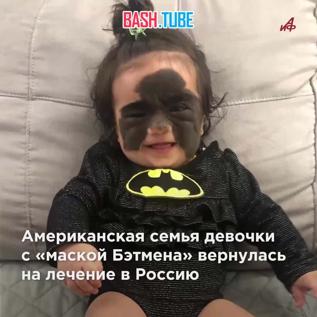 ⁣ Американскую девочку с «маской Бэтмена» смог спасти только русский хирург