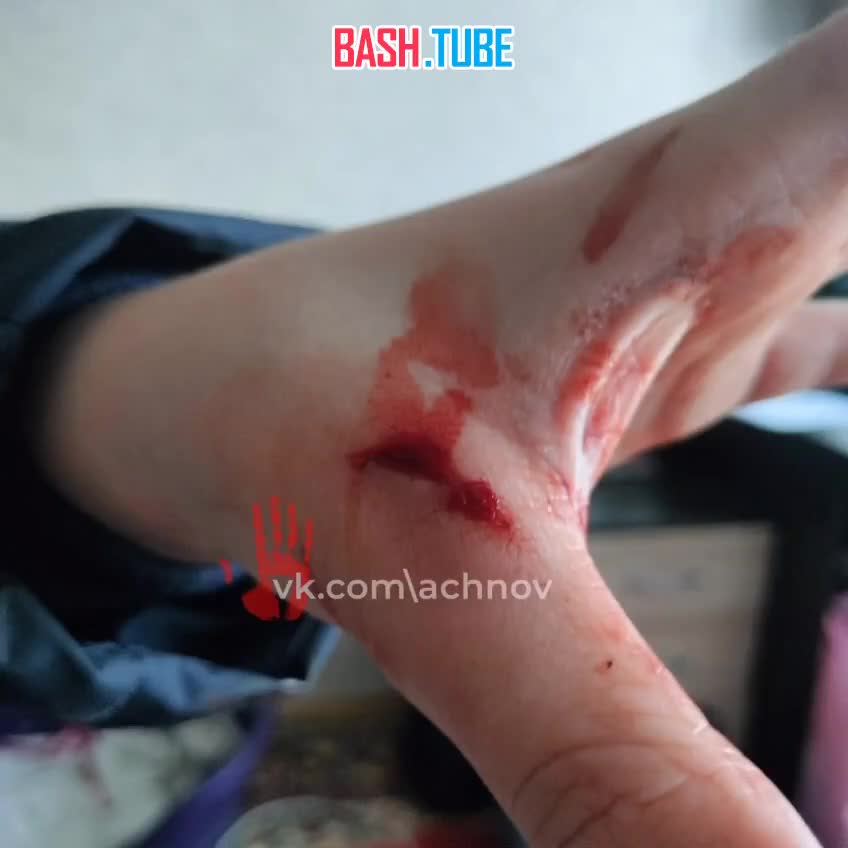 ⁣ Девочка в маске панды порезала ребёнка в Курчатовском районе