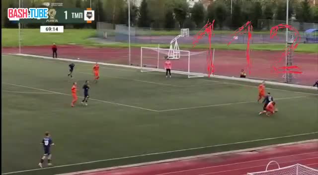  В Кузбассе после поражения своей команды футболист так расстроился, что сломал челюсть сопернику в двух местах