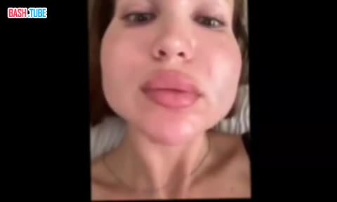  «Накачали лицо препаратами для увеличения члена»