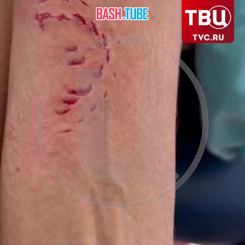  Акула-нянька укусила россиянку во время экскурсии на Мальдивах