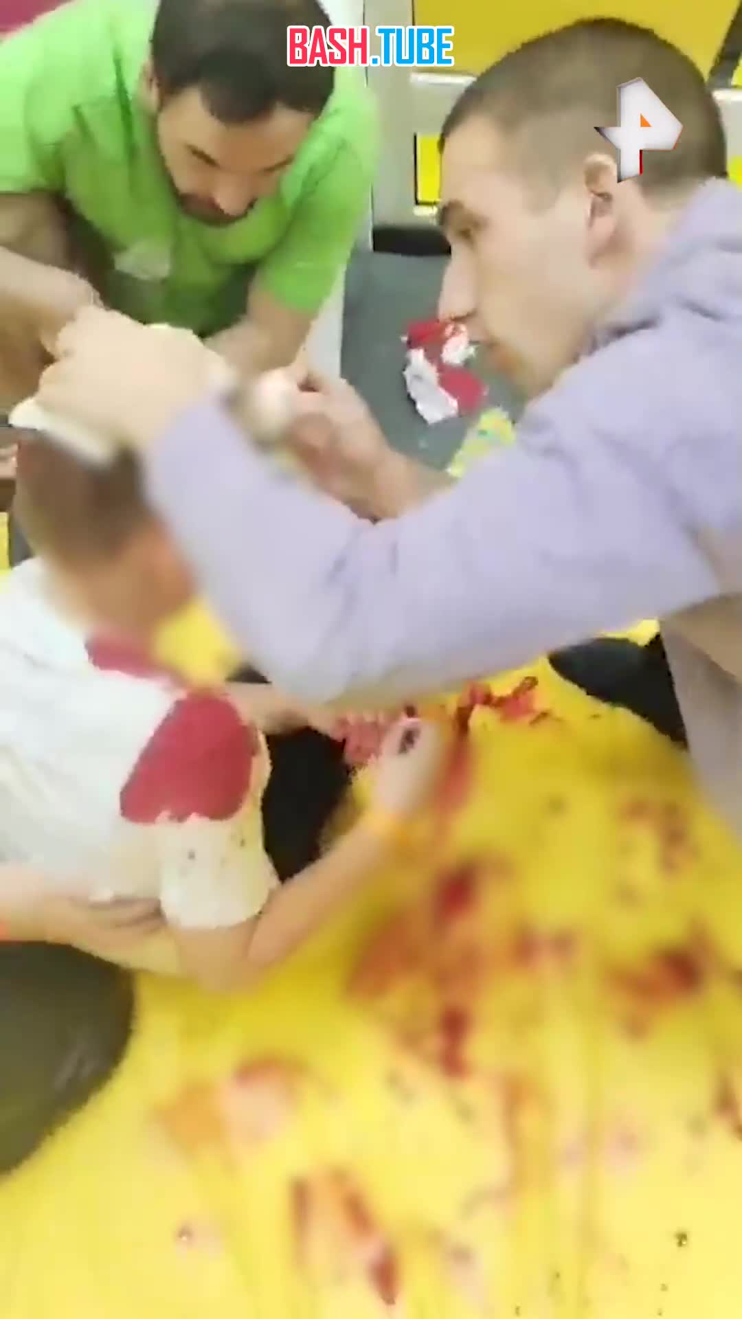  Железный болт пробил голову ребенку, который упал с тарзанки в развлекательном центре в Омске