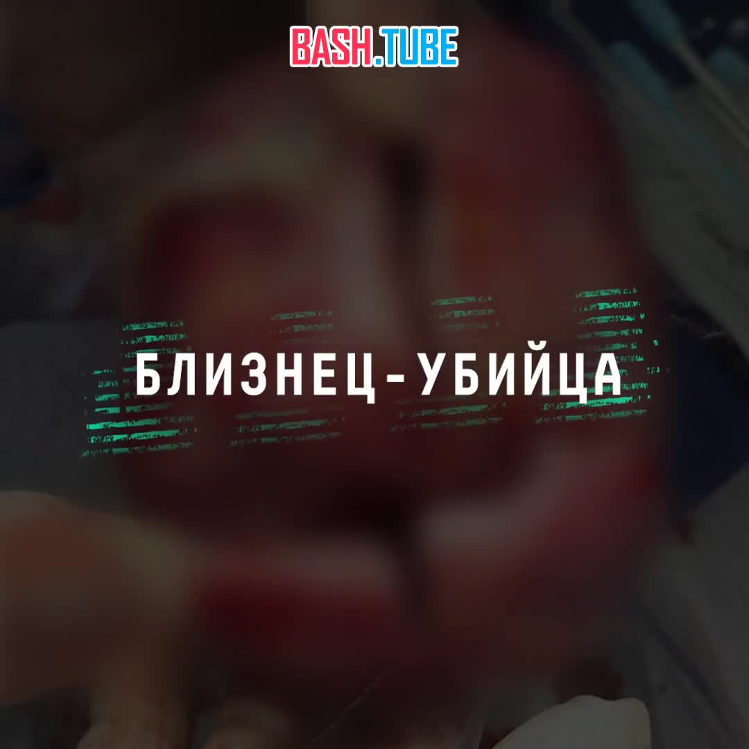  Жуткий медицинский случай из Египта