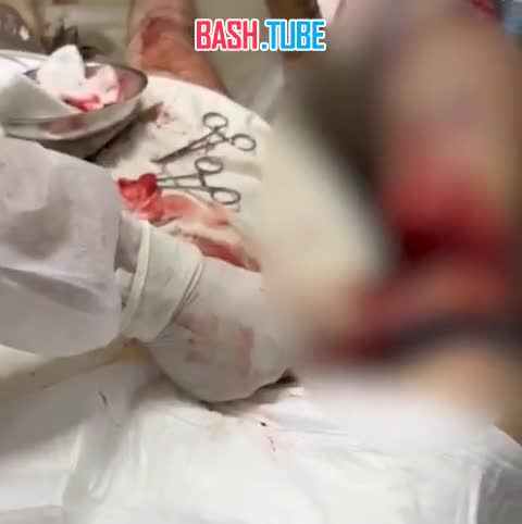  Российские медики спасли украинского солдата, который до последнего отстреливался и боялся попасть в плен