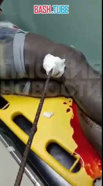  В Доминикане рабочий проткнул себе рот и шею арматурой