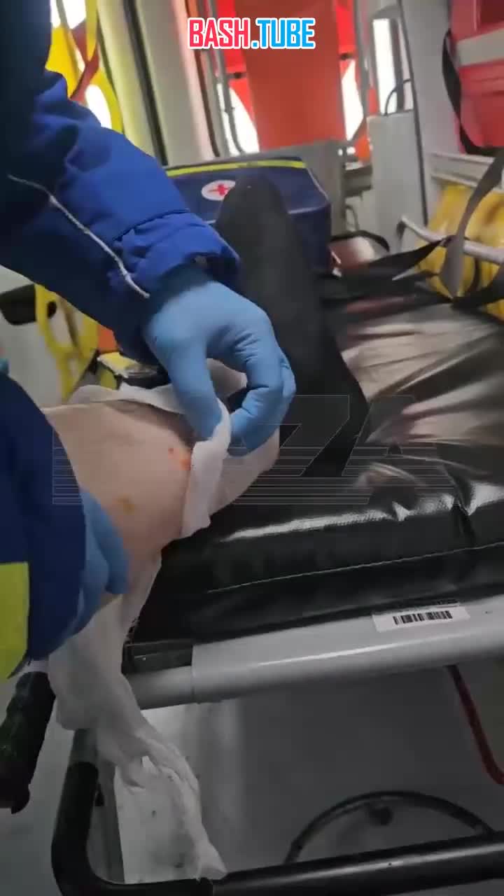  Мужчине, которого снесло волной от обрушения «Снежкома», пробило осколками ноги