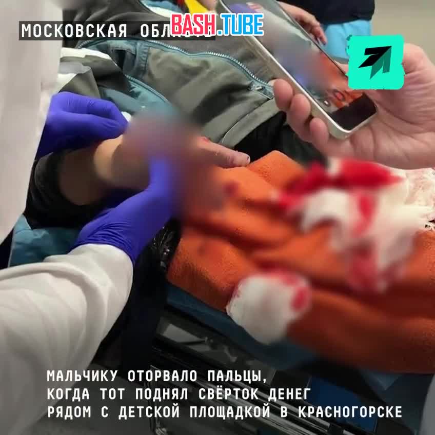  Мальчику оторвало пальцы, когда тот поднял свёрток денег рядом с детской площадкой в Красногорске