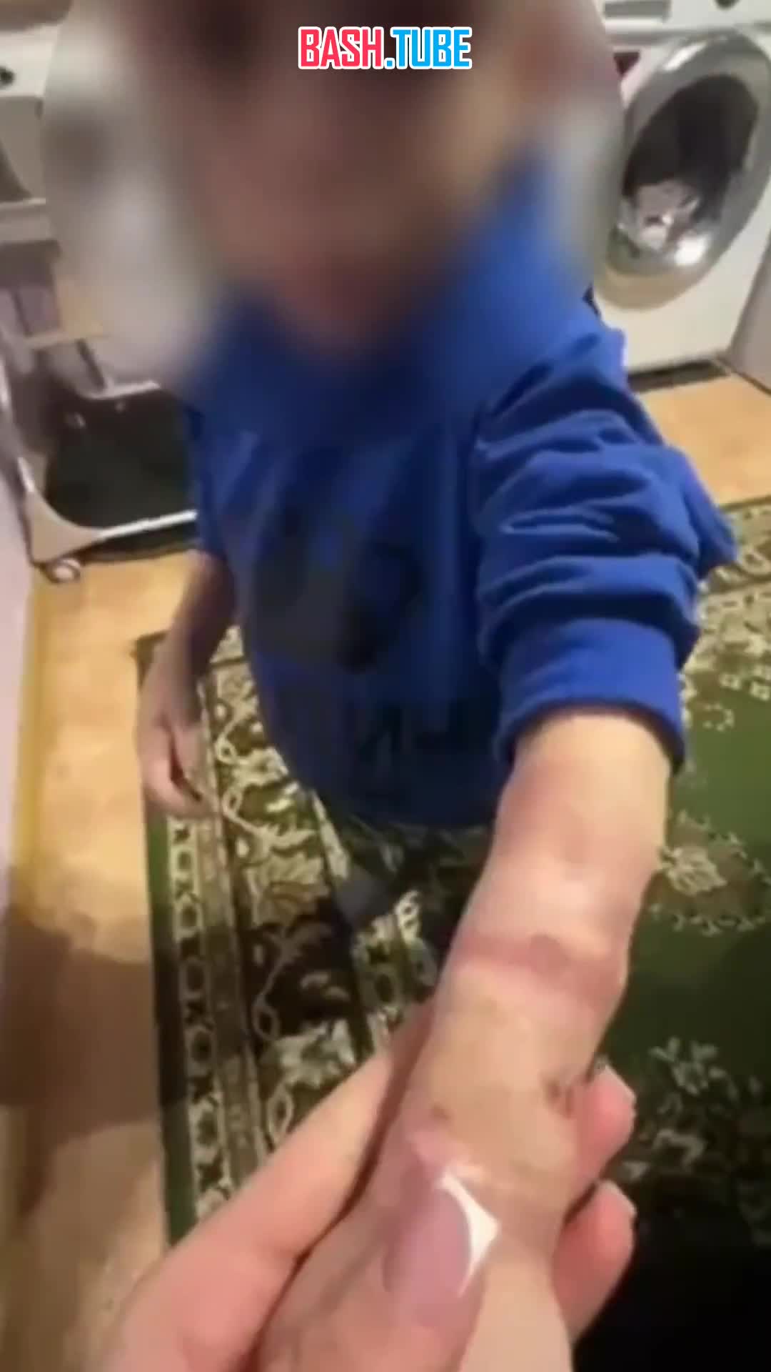  В Якутии мать жестоко избивала сына и морила его голодом