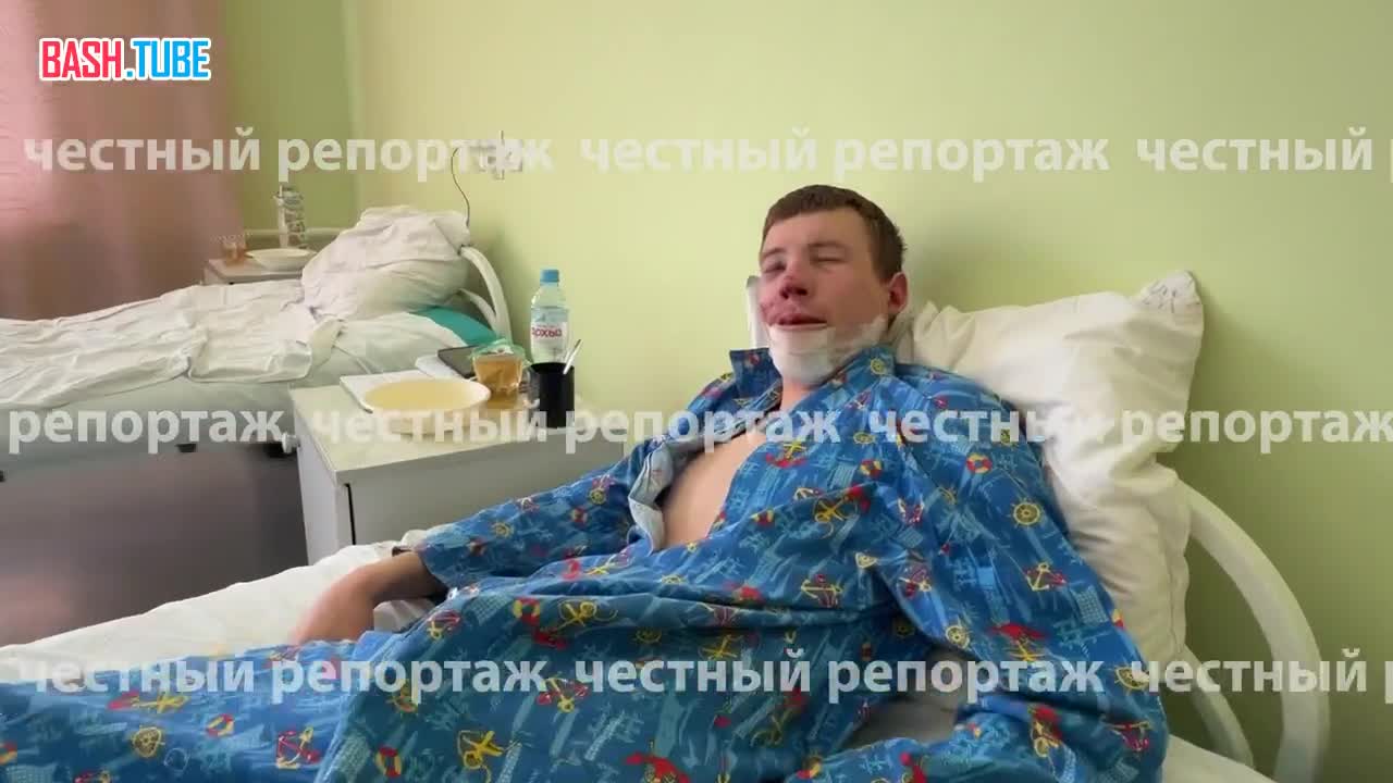  Парня, сделавшего замечание пьяным водителям, сбили на машине и избили до переломов
